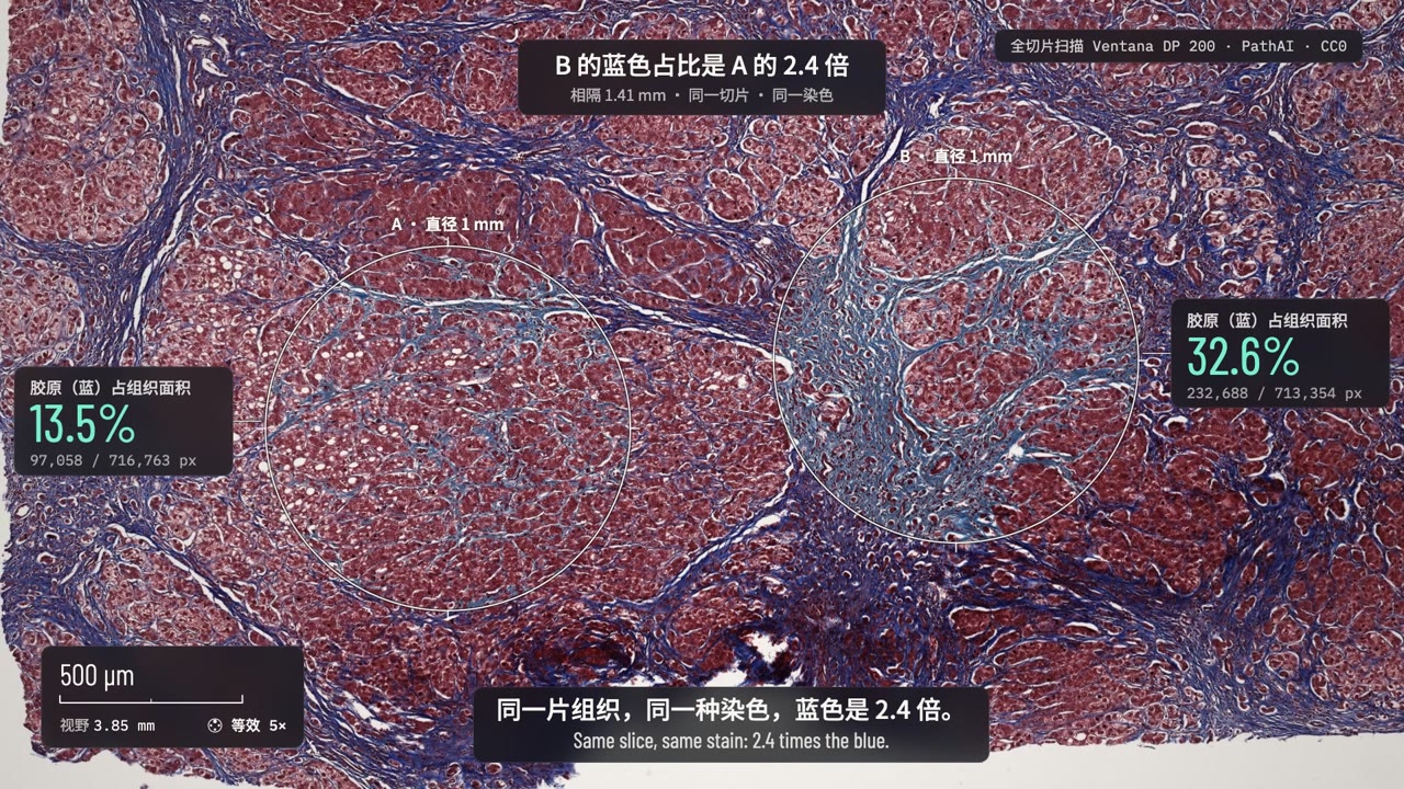 Microscope Story — Measured Blue
